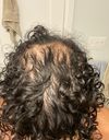Thoughts on realistic expectations (pics 1mg finasteride only)