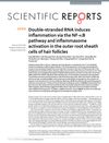 Double-Stranded RNA Induces Inflammation via the NF-κB Pathway and Inflammasome Activation in the Outer Root Sheath Cells of Hair Follicles
