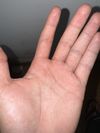 Am i balding? what should i do ? i need help