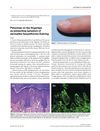 Petechiae on the Fingertips as Presenting Symptom of Dermatitis Herpetiformis Duhring