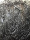 Confused as a 18M who has been experiencing thinning for around 3 years