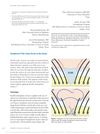 Treatment of Thin Linear Scars on the Scalp