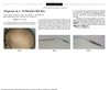 Alopecia in a 19-Month-Old Boy