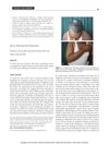 Severe Marking-Nut Dermatitis