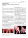 Skin Hyperpigmentation and Increased Angiogenesis Secondary to Vitamin B12 Deficiency in a Young Vegetarian Woman