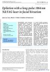 Epilation With a Long-Pulse 1064nm Nd:YAG Laser in Facial Hirsutism