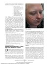 Dasatinib-Induced Leukotrichia in a Patient With Chronic Myelogenous Leukemia