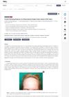 Frontal Fibrosing Alopecia: An Observational Single-Center Study of 306 Cases