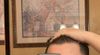 New to hair loss treatments, what should I use?