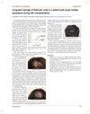 Long-Term Storage of Follicular Units in a Patient With Acute Cardiac Symptoms During Hair Transplantation