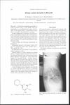 Allergic Contact Dermatitis to Minoxidil