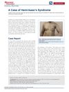 A Case of Hemi-Isaac's Syndrome