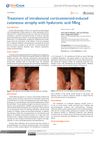 Treatment of Intralesional Corticosteroid-Induced Cutaneous Atrophy with Hyaluronic Acid Filling