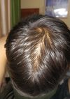Is it worth incorporating Minox into my routine?
