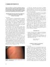 Focal Hypertrichosis During Topical Tacrolimus Therapy for Childhood Vitiligo