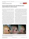 Erosive Pustular Dermatosis of the Scalp Following Topical Ingenol Mebutate for Actinic Keratoses