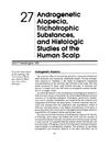 Androgenetic Alopecia, Trichotrophic Substances, and Histologic Studies of the Human Scalp
