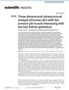 Three-Dimensional Ultrastructural Analysis of Human Skin with the Arrector Pili Muscle Interacting with the Hair Follicle Epithelium