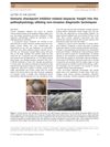 Immune Checkpoint Inhibitor-Related Alopecia: Insight into the Pathophysiology Using Non-Invasive Diagnostic Techniques