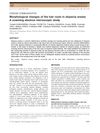 Morphological Changes of the Hair Roots in Alopecia Areata: A Scanning Electron Microscopic Study