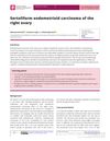 Sertoliform Endometrioid Carcinoma of the Right Ovary