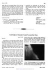 Scale Heights of Chemically Treated Wool and Hair Fibers