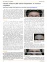 Folliculitis And Scarring After Eyebrow Transplantation: An Uncommon Complication
