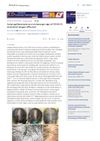 Scalp Capillarectasia as a Trichoscopic Sign of COVID-19-Associated Telogen Effluvium