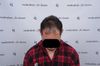 12 Months Post-FUE, Concerned About Stopping Minoxidil - Will Hair Shed?