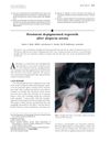 Persistent Depigmented Regrowth After Alopecia Areata