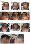 Seeking Advice on Next Steps After Multiple Treatments