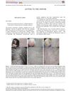 Trichoscopy-Assisted Hair Pull Test: A Helpful Adjunct to Trichoscopy for Diagnosing and Managing Alopecias