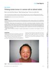 Virilizing Ovarian Tumor in a Woman with an Adrenal Nodule