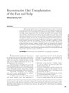 Reconstructive Hair Transplantation of the Face and Scalp
