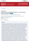 Traumatic Anserine Folliculosis: A Cause of Facial Follicular Papules