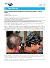 Atypical Kawasaki Disease Presenting as Telogen Effluvium in an 11-Year-Old Female