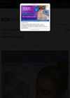Traction Alopecia