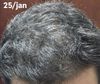 In need of some guidance in my hair treatment journey