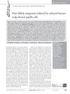 Hair Follicle Neogenesis Induced by Cultured Human Scalp Dermal Papilla Cells