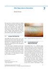 Skin Signs Due to Starvation