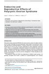 Endocrine and Reproductive Effects of Polycystic Ovarian Syndrome