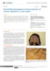 Frontal Fibrosing Alopecia During Treatment of Chronic Hepatitis C: A Case Report