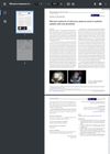 Effective Treatment of Refractory Alopecia Areata in Pediatric Patients With Oral Abrocitinib