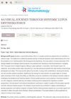 A Visual Journey Through Systemic Lupus Erythematosus