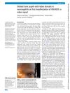 Dilated Tonic Pupils with Tabes Dorsalis in Neurosyphilis as First Manifestation of HIV/AIDS: A Video Report
