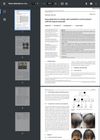 Gene Detection in a Family With Monilethrix and Treatment With 5% Topical Minoxidil