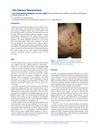 Noncancerous Skin Diseases: Overview and Treatments