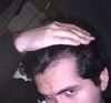 Can i save this hairline
