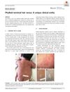 Phylloid Terminal Hair Nevus: A Unique Clinical Entity
