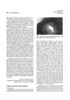 Alopecia Associated With Syringomas